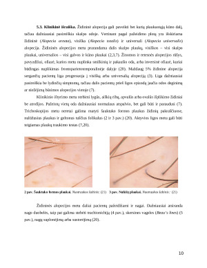 Vaikų židininė alopecija rizikos veiksnių ir gydymo vertinimas. Paveikslėlis 10