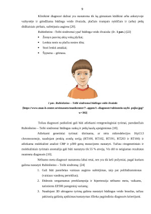 KINEZITERAPIJOS POVEIKIS PACIENTAMS, SERGANTIEMS RUBINŠTEINO – TEIBI SINDROMU. Paveikslėlis 9