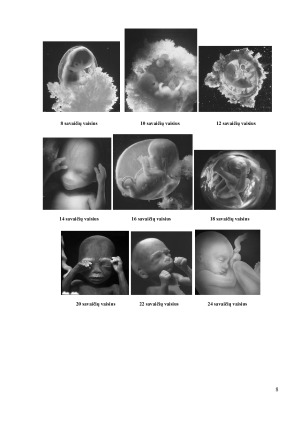 Žmogaus gimimas. Paveikslėlis 8