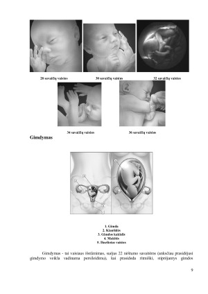 Žmogaus gimimas. Paveikslėlis 9