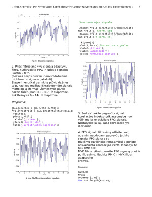 Adaptyvus judesio trukdžių filtravimas. Paveikslėlis 9