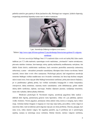 MOTERŲ VALGYMO SUTRIKIMAI IR JŲ PRIEŽASTYS ŠIUOLAIKINĖJE VISUOMENĖJE. Paveikslėlis 8