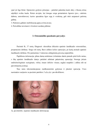 Osteomielitas ir jo reikšmė stomatologijoje. Paveikslėlis 7