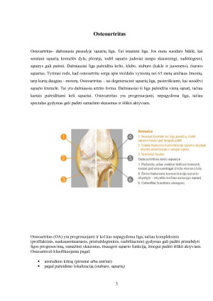 Osteoartritas. Paveikslėlis 3