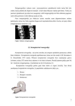STUBURO SLANKSTELIŲ PAŽEIDIMAI IR JŲ TYRIMAI. Paveikslėlis 7