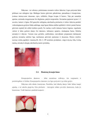 RŪKYMO ĮTAKA BURNOS  SVEIKATAI. Paveikslėlis 5