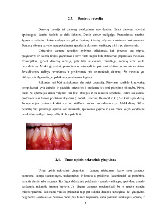 RŪKYMO ĮTAKA BURNOS  SVEIKATAI. Paveikslėlis 6