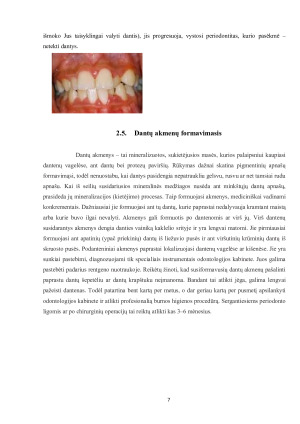 RŪKYMO ĮTAKA BURNOS  SVEIKATAI. Paveikslėlis 7