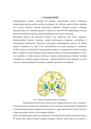 PARKINSONO LIGA. Paveikslėlis 5