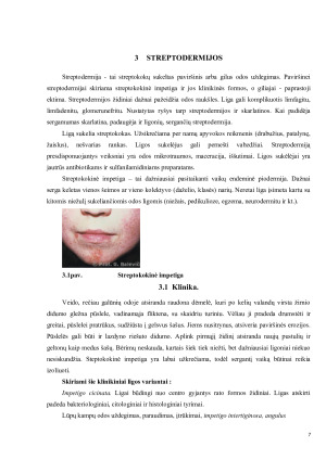 STREPTOKOKŲ SUKELTOS ODOS INFEKCIJOS. Paveikslėlis 7