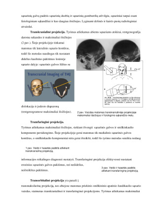SMILKININIO ŽANDIKAULIO SĄNARIO DISFUNKCIJOS RADIOLOGINĖ DIAGNOSTIKA. Paveikslėlis 3
