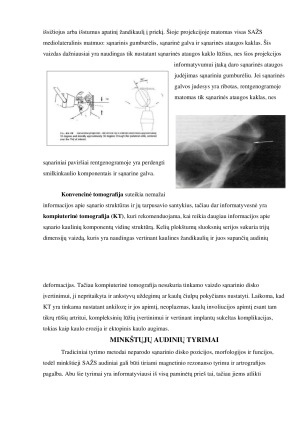 SMILKININIO ŽANDIKAULIO SĄNARIO DISFUNKCIJOS RADIOLOGINĖ DIAGNOSTIKA. Paveikslėlis 4