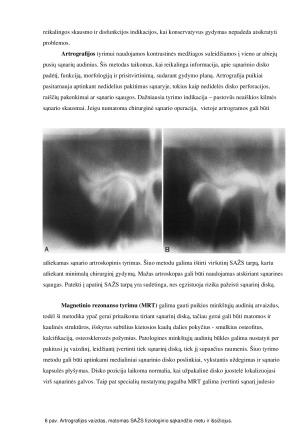 SMILKININIO ŽANDIKAULIO SĄNARIO DISFUNKCIJOS RADIOLOGINĖ DIAGNOSTIKA. Paveikslėlis 5