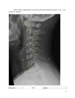 Stuburo kaklinės dalies šoninė rentgenograma. Paveikslėlis 6