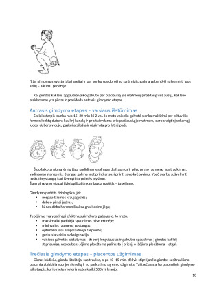 Gimdymas tupint ir ergonominės padėtys nėščiosioms kasdienėje veikloje. Paveikslėlis 10