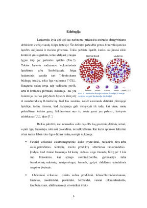 LEUKEMIJA. Paveikslėlis 6