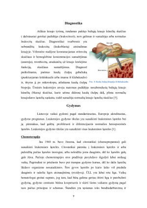 LEUKEMIJA. Paveikslėlis 9