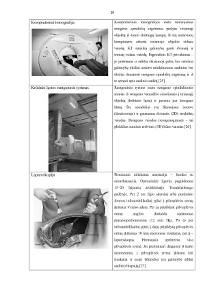 SKRANDŽIO VĖŽIO KLINIKINIAI SIMPTOMAI IR LIGONIŲ SLAUGA. Paveikslėlis 10