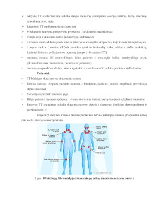 FIBROMIALGIJA. Paveikslėlis 9