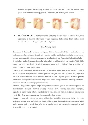 SITUACIJOS ANALIZĖ. Kosmetinių procedūrų atlikimo metodikos savarankiškas darbas. Paveikslėlis 6