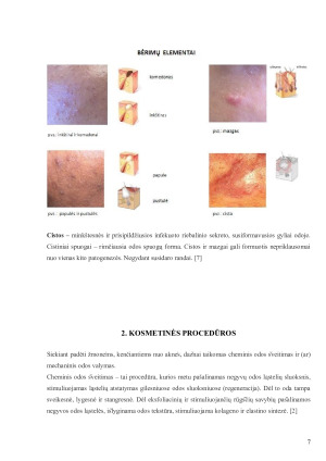 SITUACIJOS ANALIZĖ. Kosmetinių procedūrų atlikimo metodikos savarankiškas darbas. Paveikslėlis 7