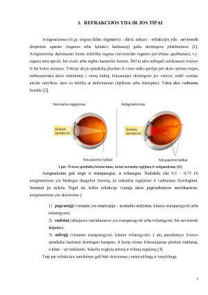 ASTIGMATIZMAS. Paveikslėlis 4