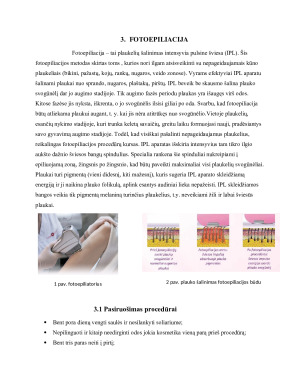 Nepageidaujamų plaukų šalinimas lazeriu bei fotoepiliacijos būdu. Paveikslėlis 10