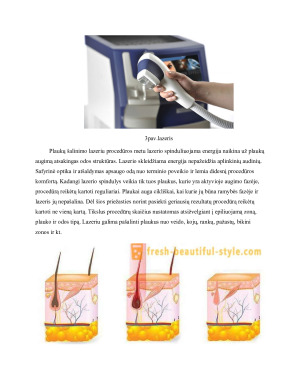 Nepageidaujamų plaukų šalinimas lazeriu bei fotoepiliacijos būdu. Paveikslėlis 6