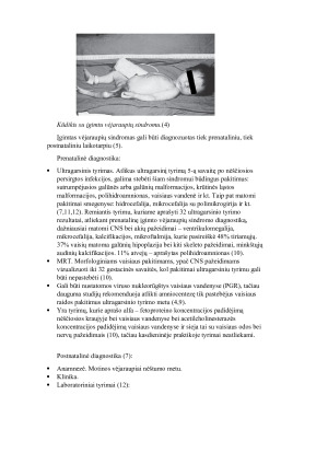 ĮGIMTAS VĖJARAUPIŲ SINDROMAS. Paveikslėlis 3