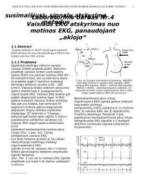 Vaisiaus EKG atskyrimas nuo motinos EKG, panaudojant „aklojo“ susimaišiusių signalų atskyrimo metodus. Paveikslėlis 1