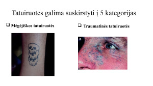 Galimybė identifikuoti asmenis pagal tatuiruotes. Paveikslėlis 3